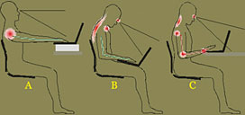 laptop ergonomics